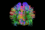 _images/tractography_small.gif